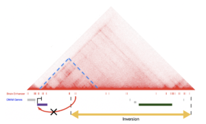 Explorations transcriptionnelles et épigénétiques dans les maladies rares